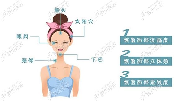 永州铂丽整形全脸脂肪填充效果